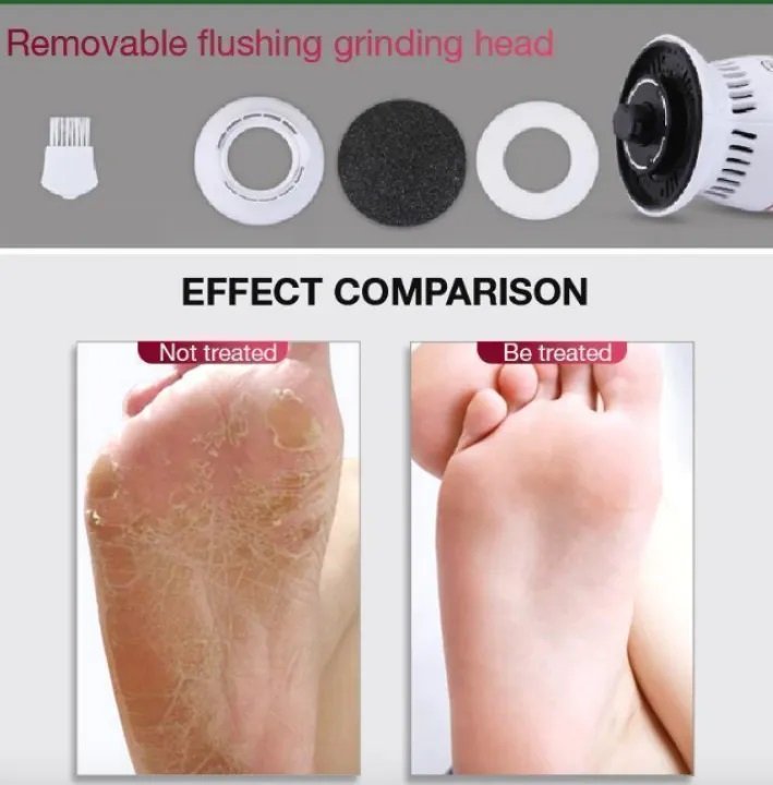Foot Pedicure Grinder at SetLife Collection 2